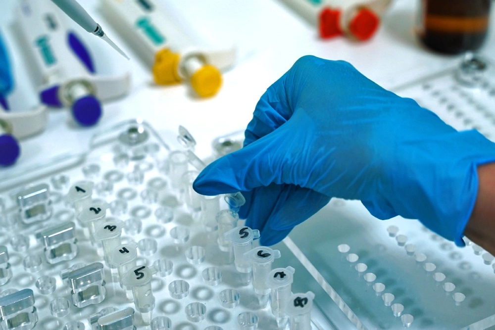 Рука в медицинское перчатке берет колбу.